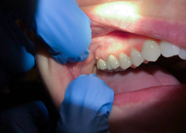 Best Urgent Care for Lost Fillings or Crowns in Emporia, KS