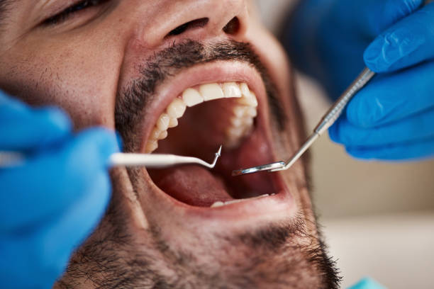 Best Emergency Tooth Extraction in Emporia, KS